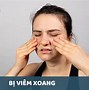 Loạn Năng Khớp Thái Dương Hàm